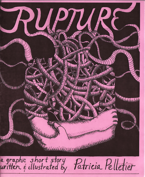 Rupture